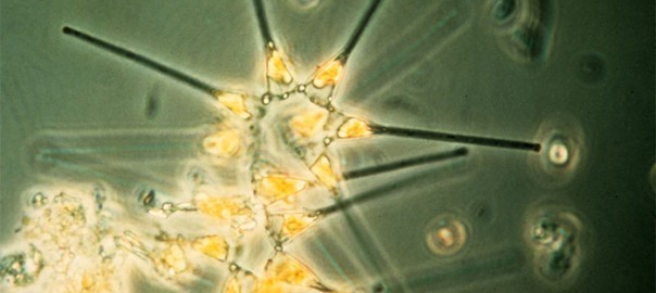 Phytoplankton - the foundation of the oceanic food chain. Image courtesy of the NOAA MESA Project.